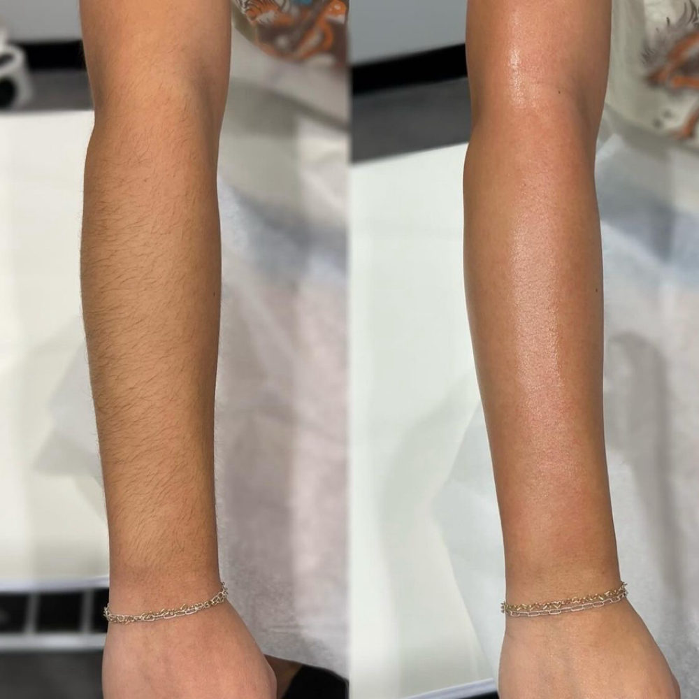 Half Arms Wax at LauLux Esthetics in Bellerose, NY