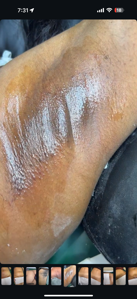 Underarm Wax