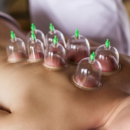90-min mobile cupping massage