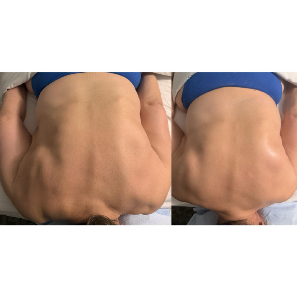 Pain Relief Medical Massage at A Lil'Bit of Healing Pain Relief