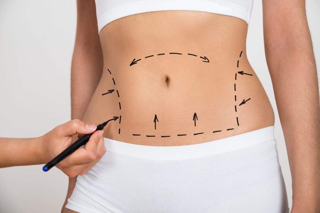 Post Surgery - Package 10 session