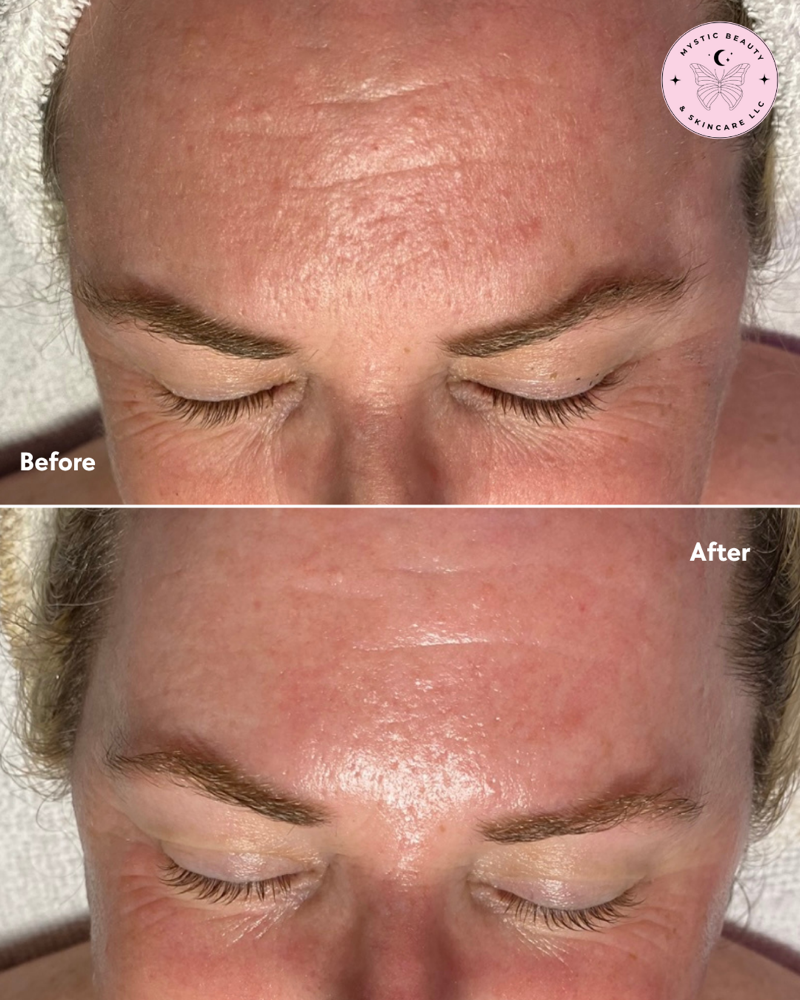 Deluxe Dermaplane Glow Facial