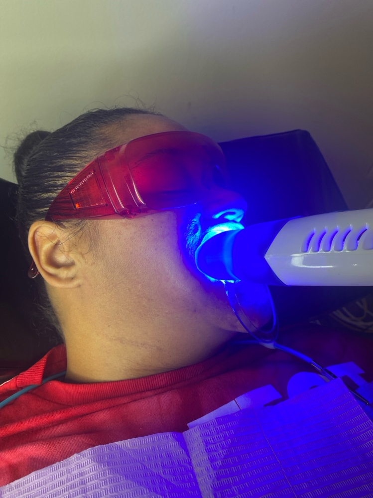 Teeth Whitening at Eximius Bella in Garner, NC