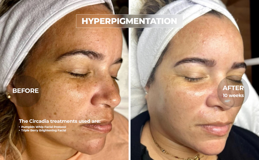 Mermaid Glow Brightening Facial