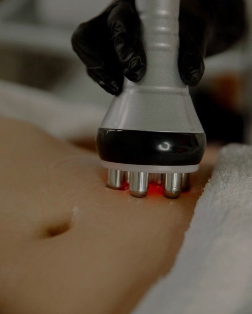 Body Sculpting Abdomen at Ashhsthetics in Southbury, CT