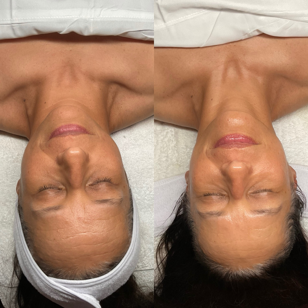 SILK Lymphatic Drainage Facial at SILK Skin Studio in Prairie Village, KS