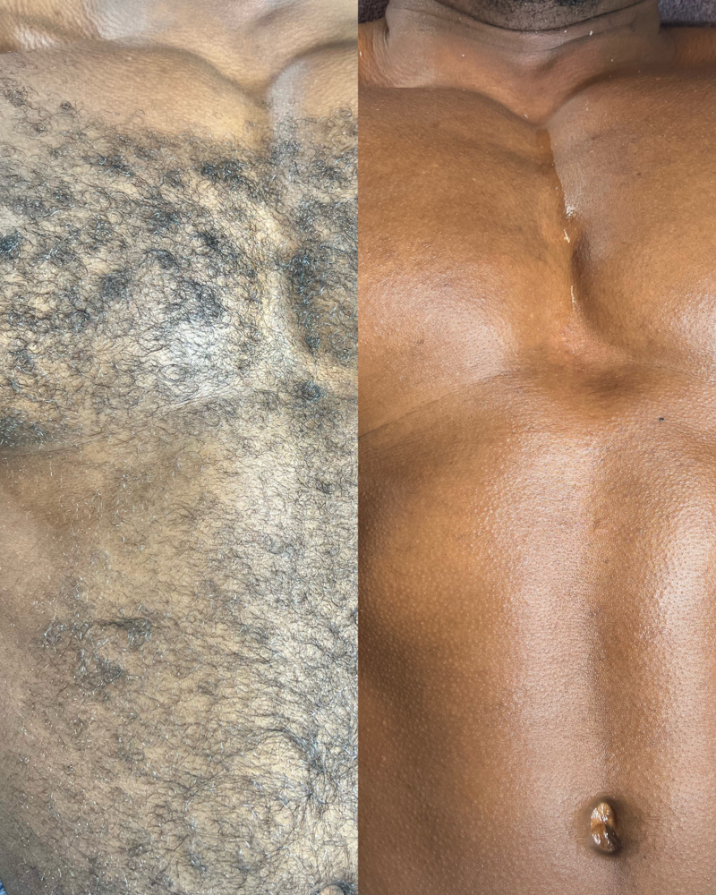 Waxing- Full Body