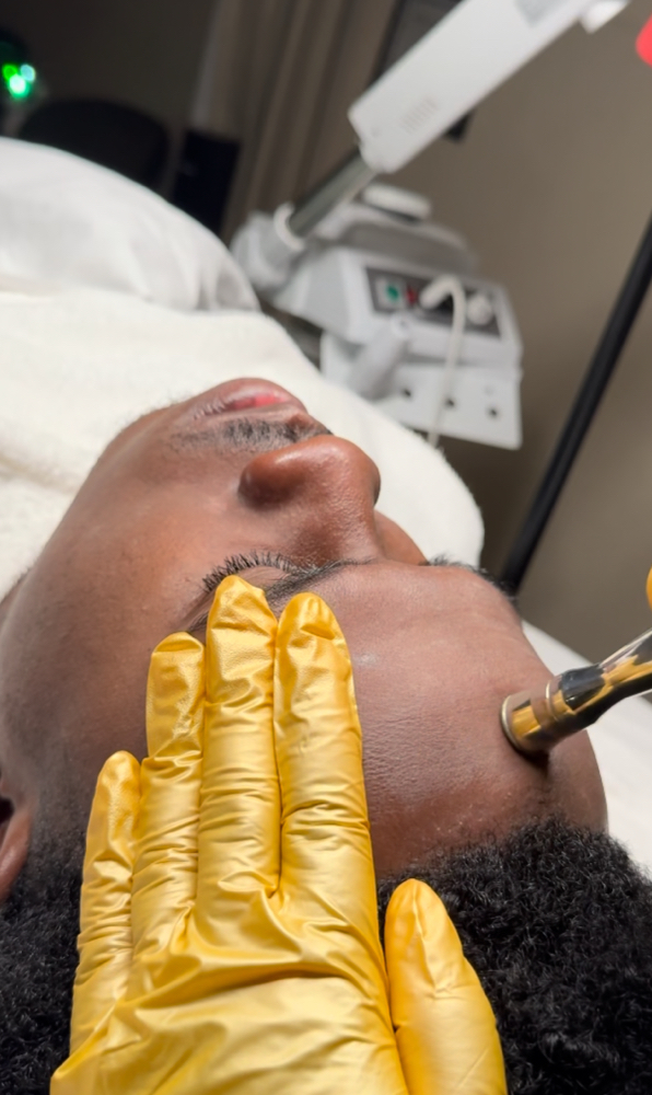 Microdermabrasion