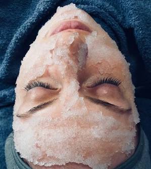 Cryotherapy facials
