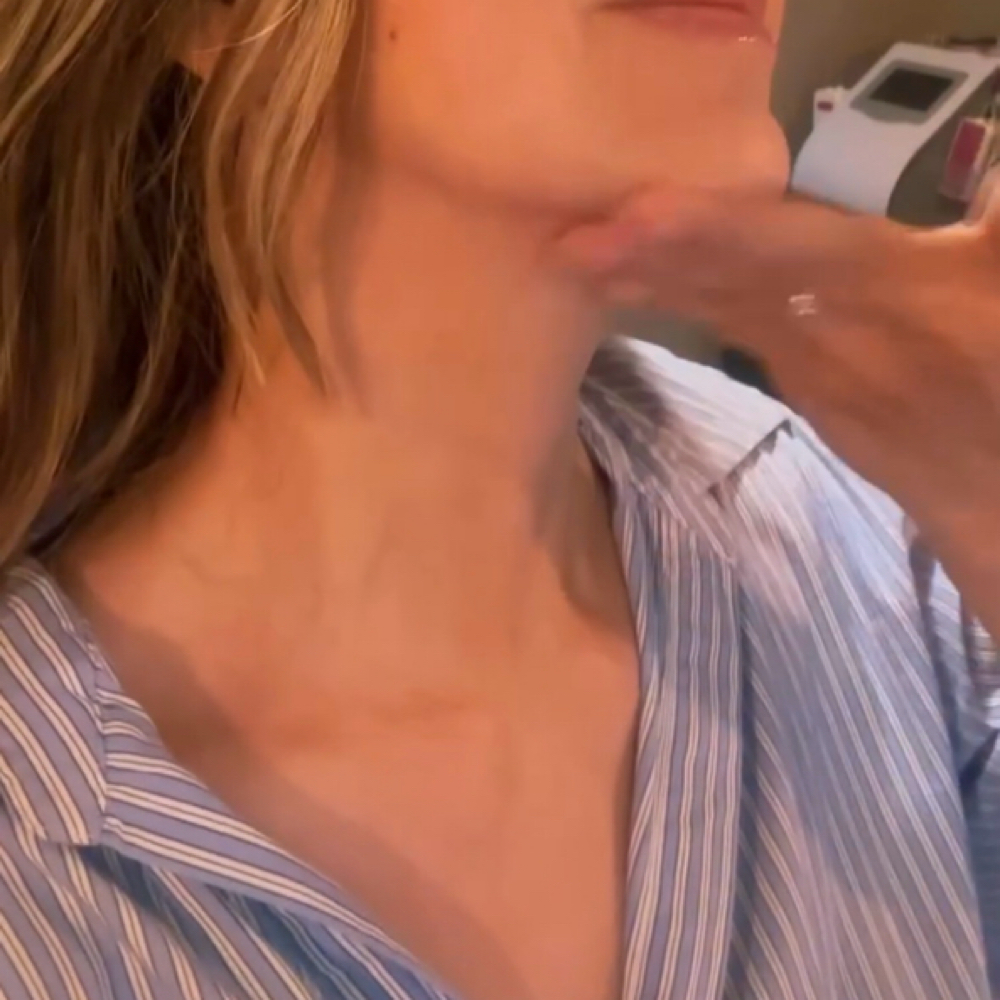 Gracefull Neck Experience at The Dermal Clinic in Lodi, CA