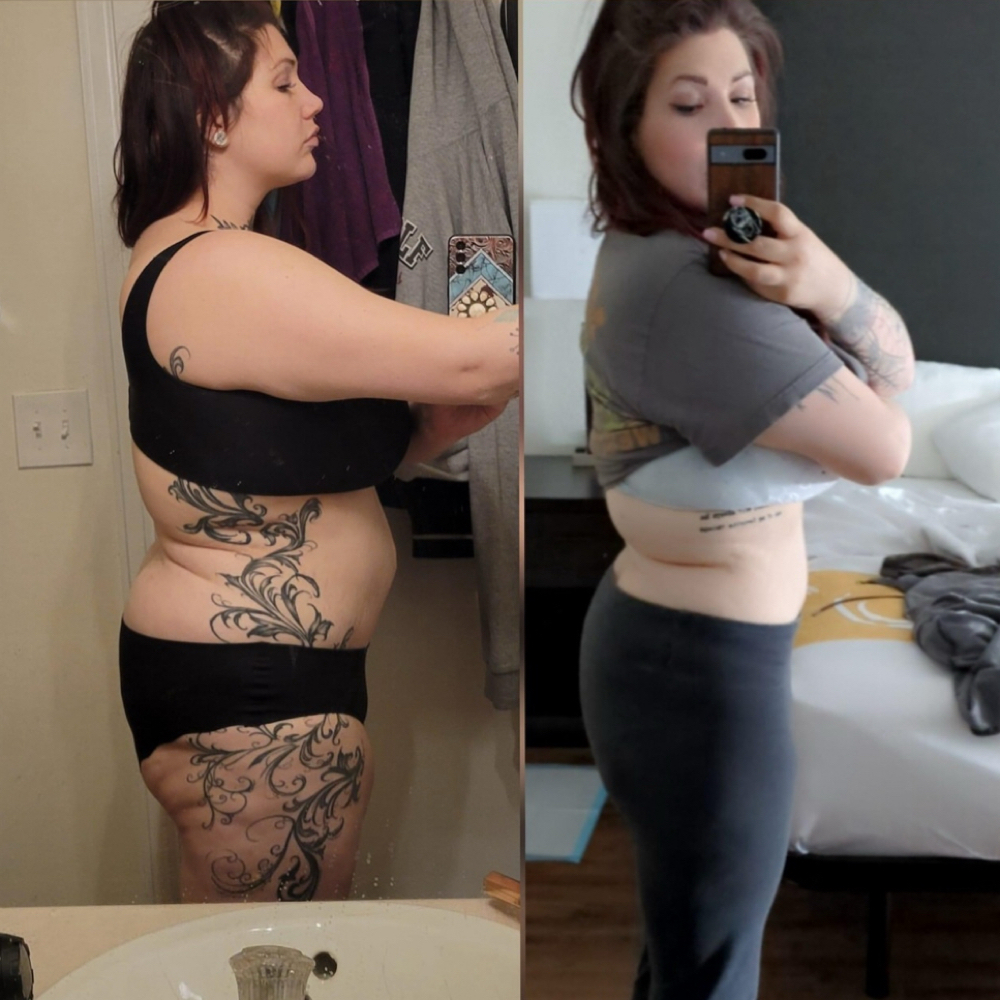 Weight Loss at Lips And Hips Beauty Bar in Modesto, CA