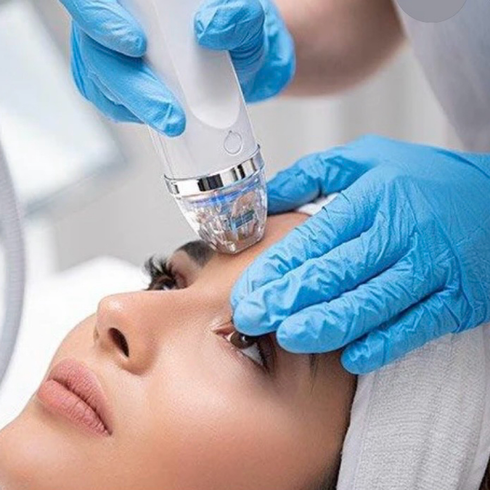 RF Microneedling Face & Neck at Luvlookbeautyspa @GlossGenius in Las Vegas, NV