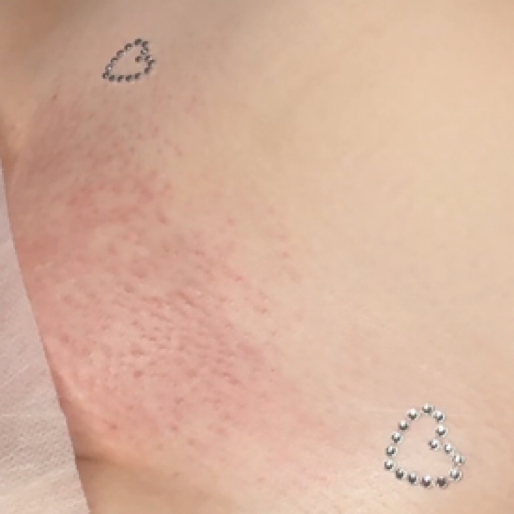 Vagazzle at LaLa Esthetics in Los Alamitos, CA