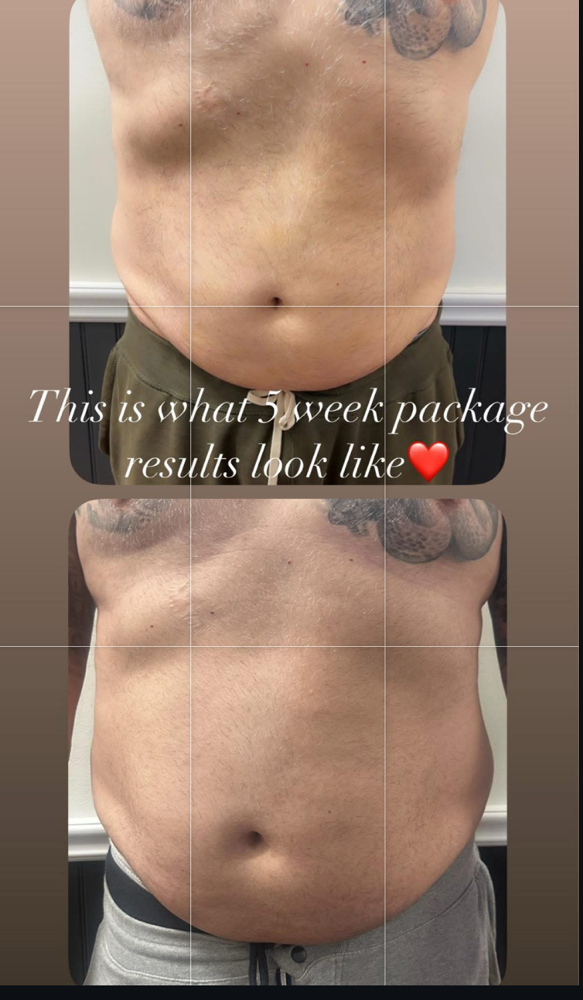 5 Weight Loss Package