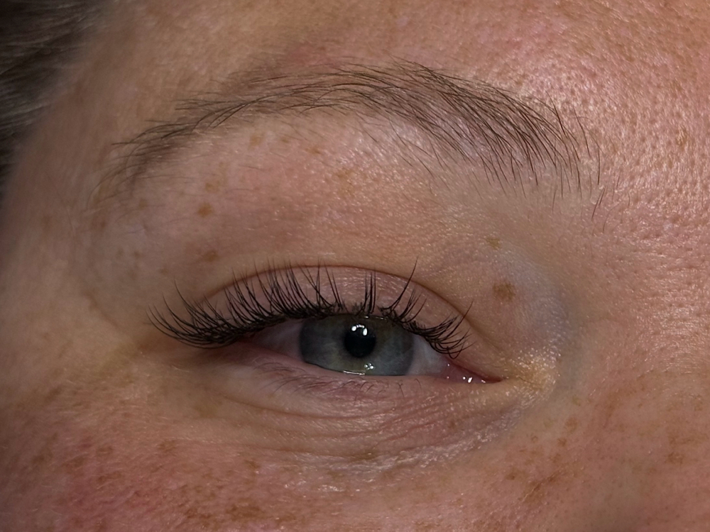Classic - 2week Fill