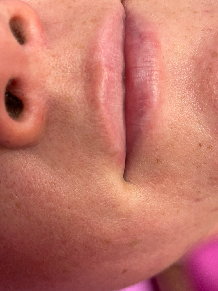 Lip Wax