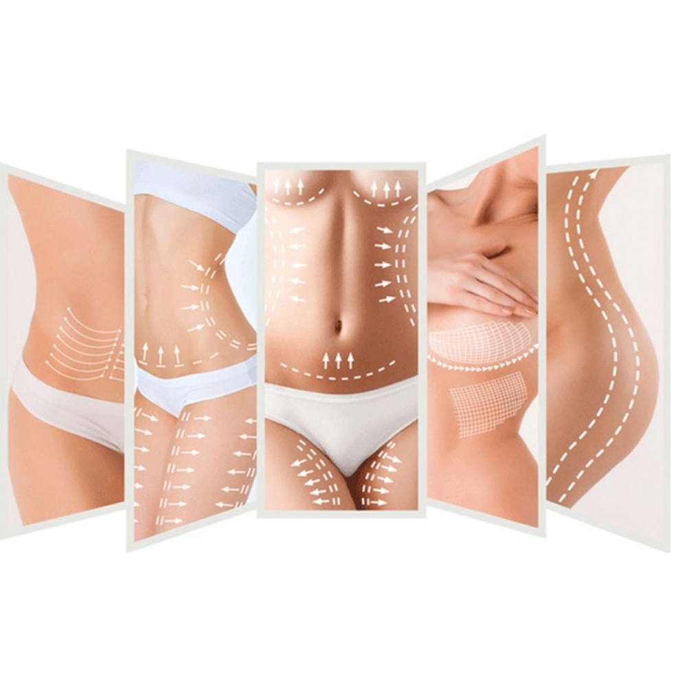Body Contouring
