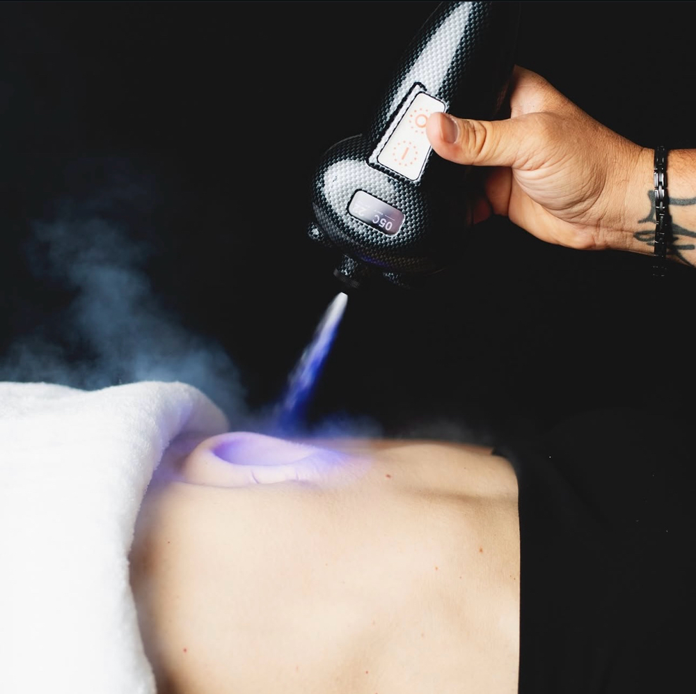 Intro Cryo Slimming 2 areas