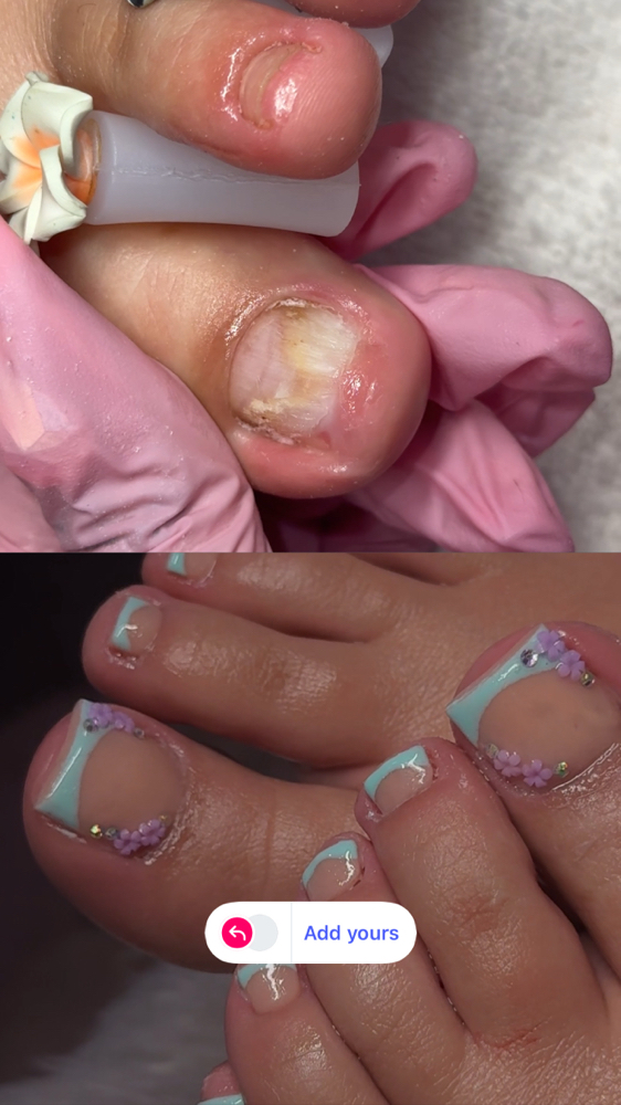 Jelly Pedi & Acrylic Reconstruction