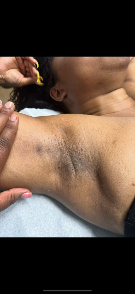 Underarm wax