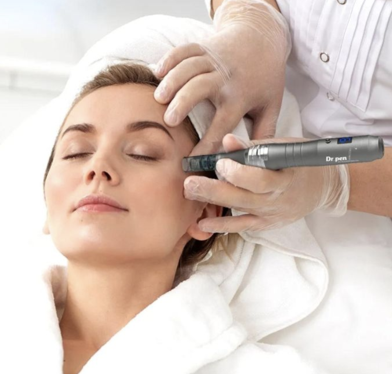 Microneedling