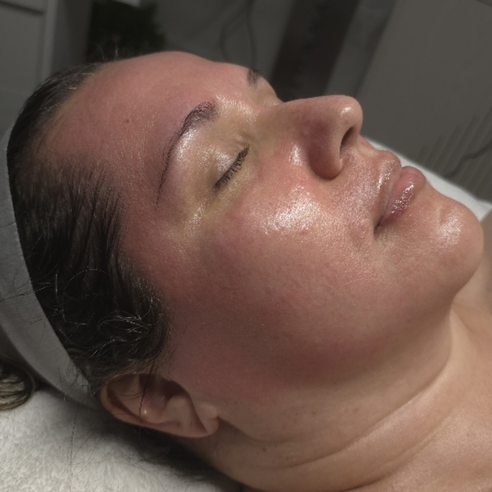 A1 BioRePeel Blue (not for new clients) at Stephs A1 Beauty Bar in Southwest Ranches, FL