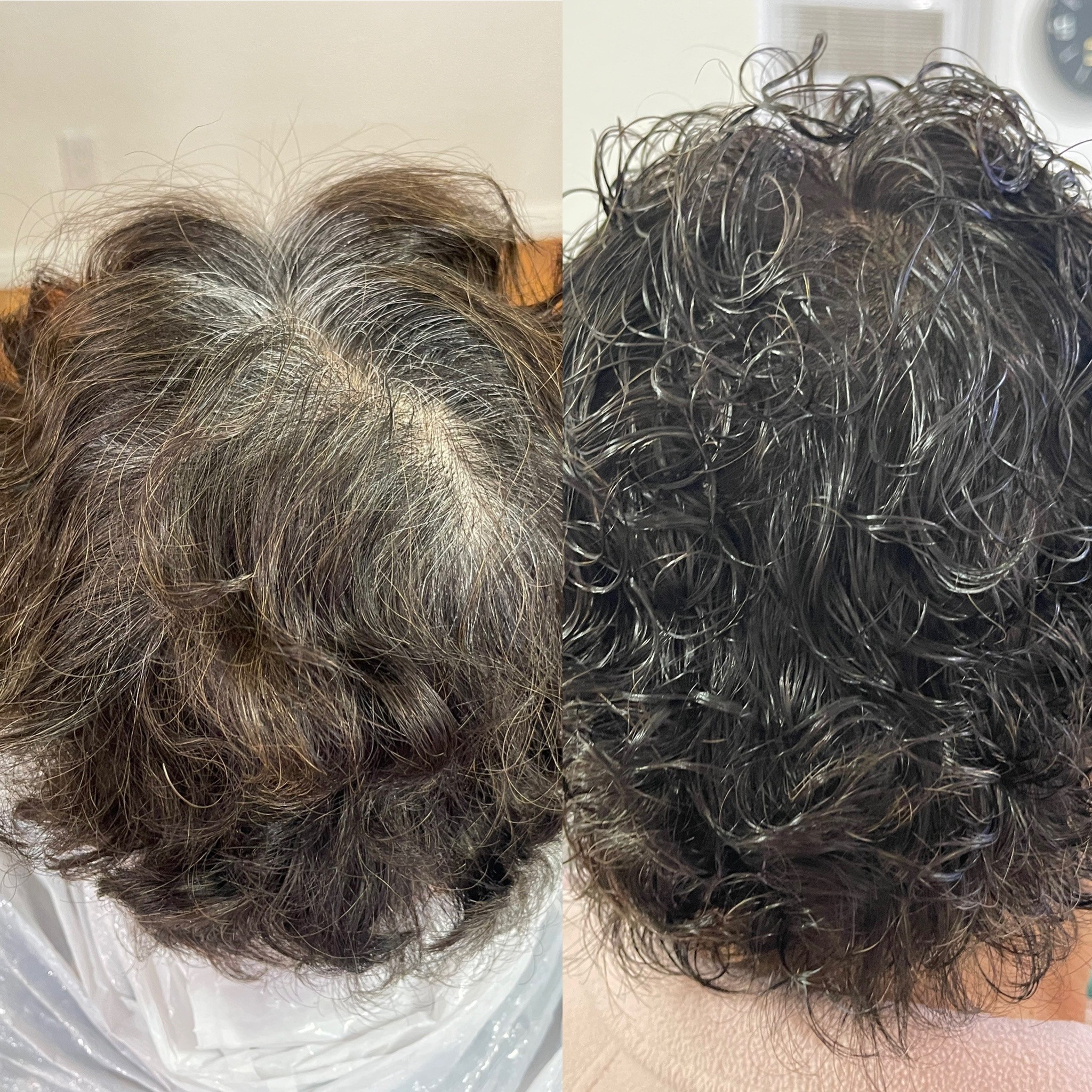 Root Touchup