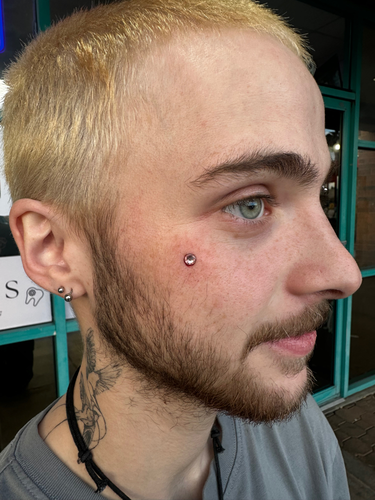 Cheek Dermal