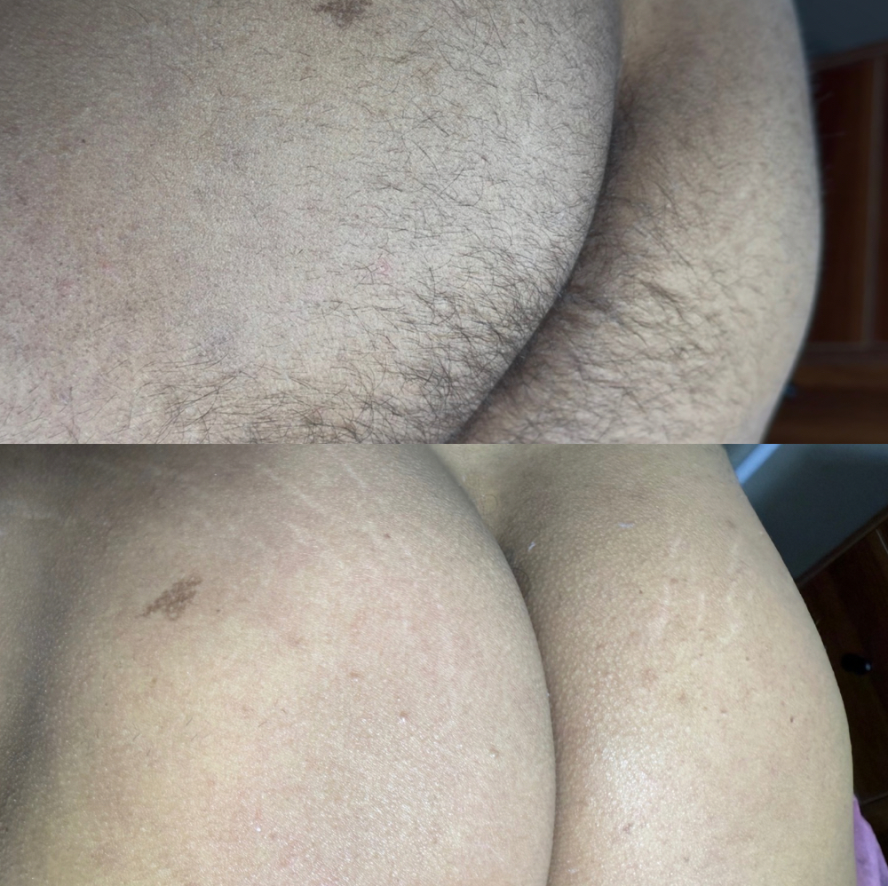 Full Booty at Classic Waxing Co in La Habra, CA