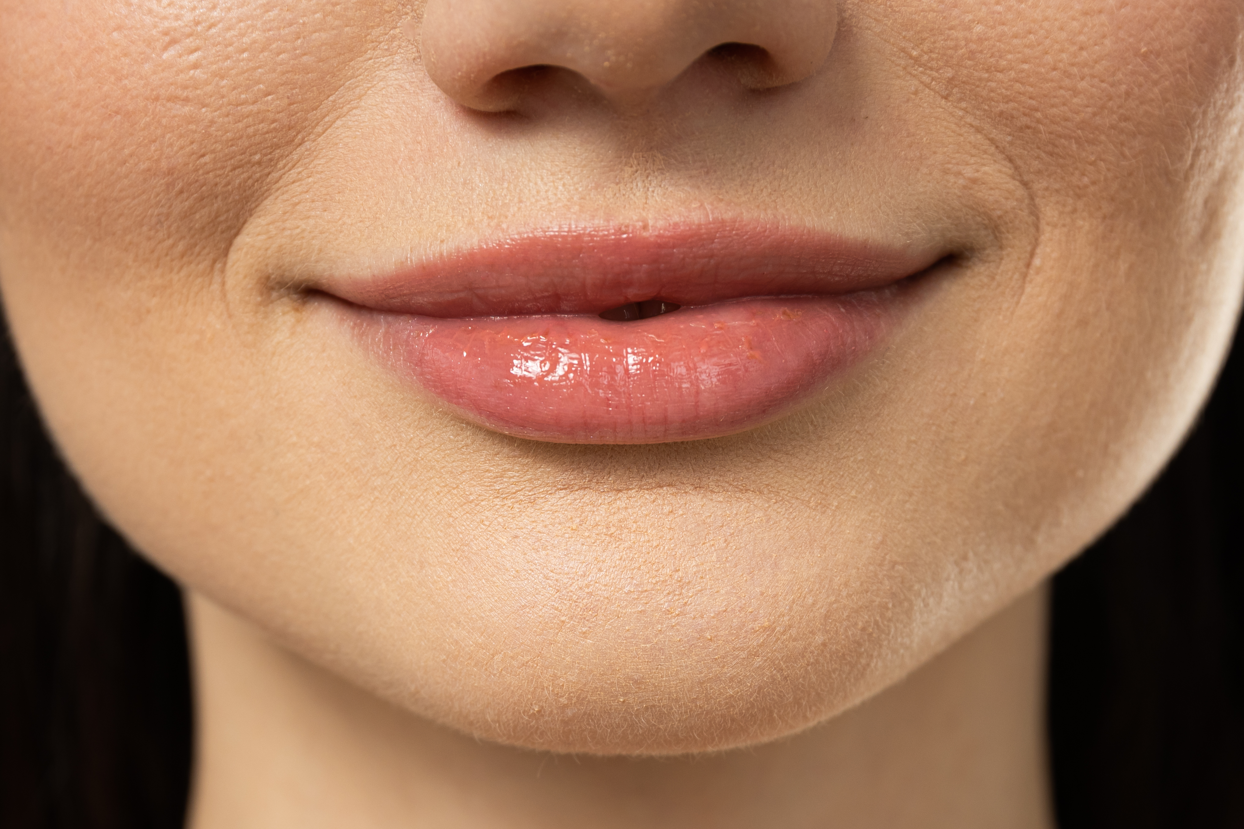 Wax (Upper Lip)