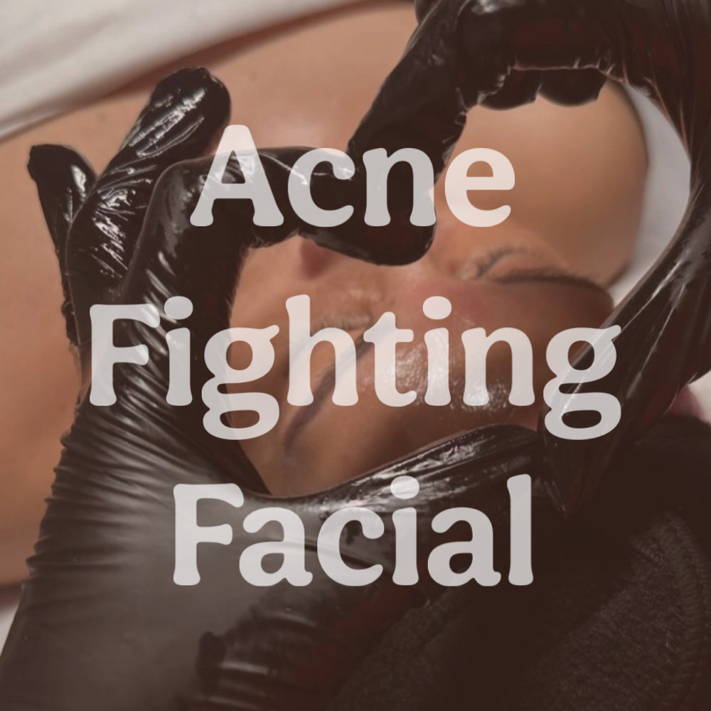 Acne Fighting Facial
