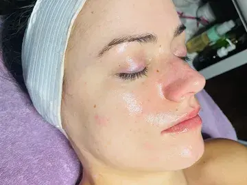 Customized facial