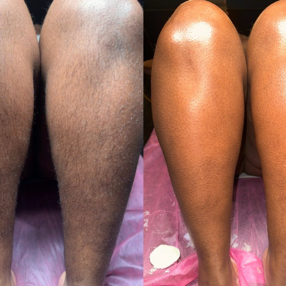Full Leg Wax at She Esthetics LLC in Columbus, GA