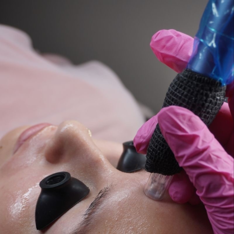 Nano Infusion at The Skin Sanctuary in Murfreesboro, TN