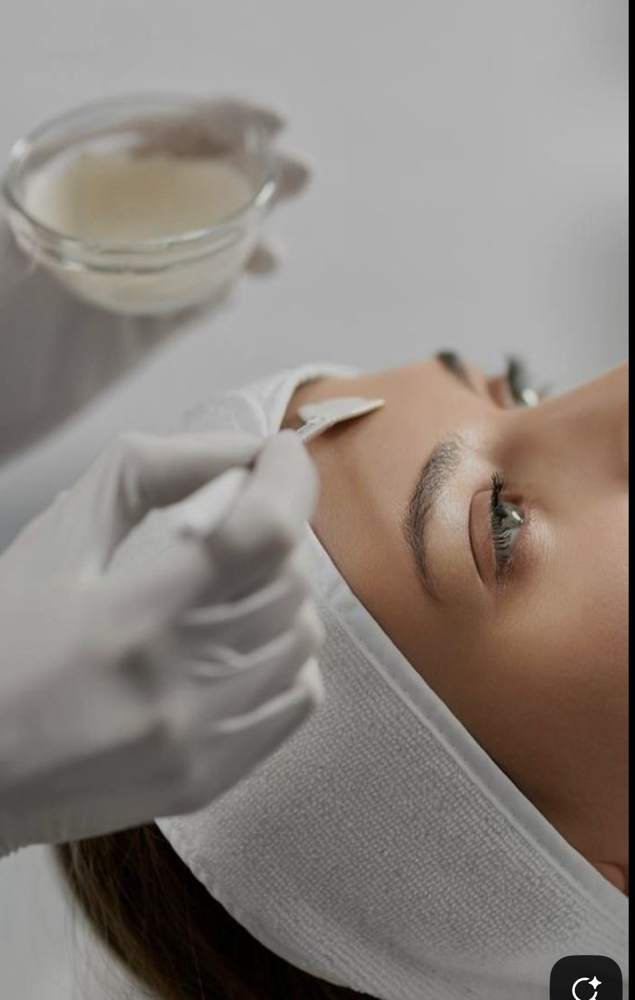 Chemical Peel