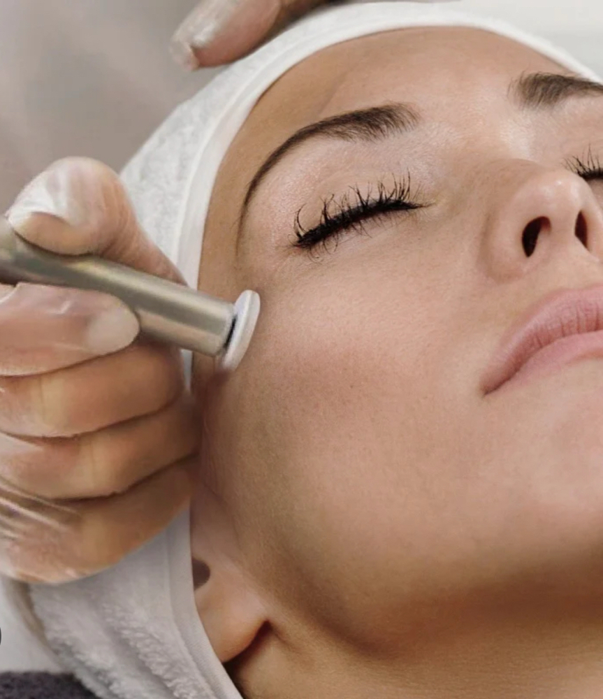 Microneedling  Face & Neck