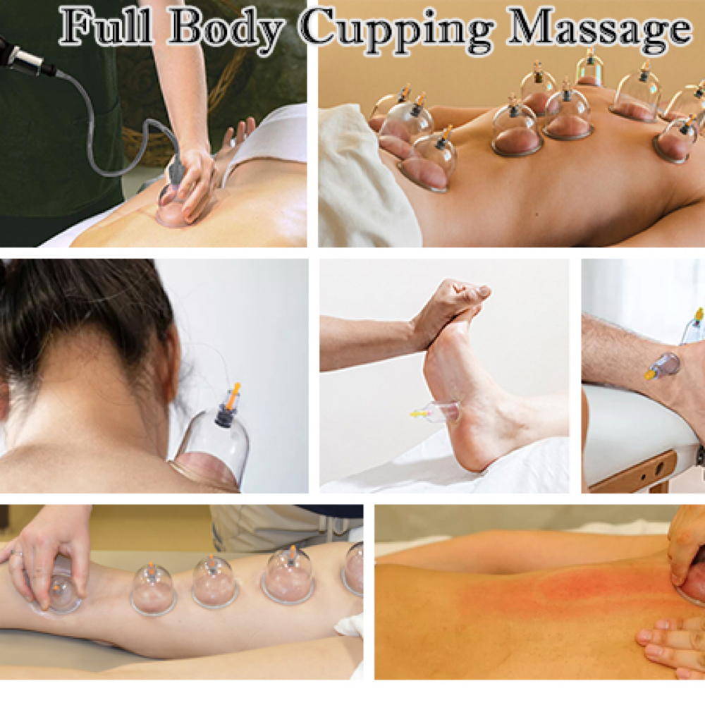 *Full Body*~Cupping at Complexions Esthetics llc in Forked River, NJ