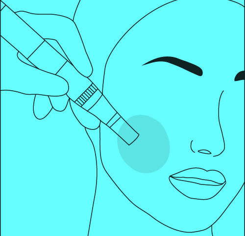 Microneedling at Expressions by Dawn - The Beauty Bar in St Louis, MO