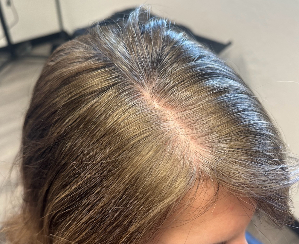 Gray Coverage Roots Only