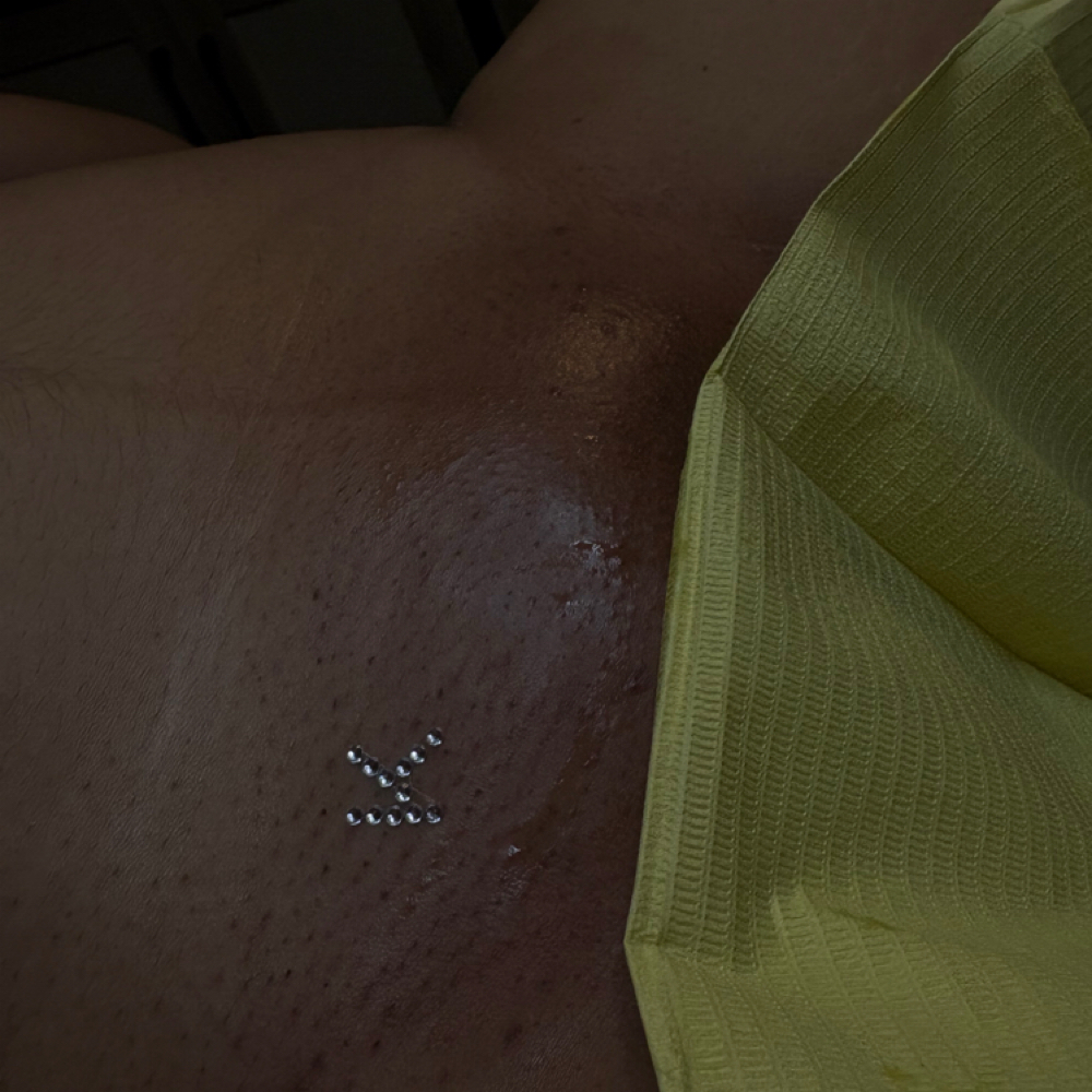 Vajazzle at 5StarEsthetics in Minneapolis, MN