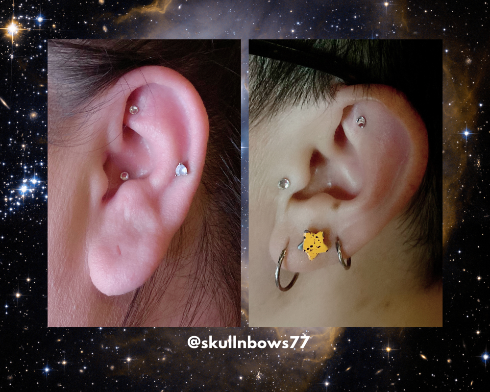 Ear Seeds Auriculotherapy Session