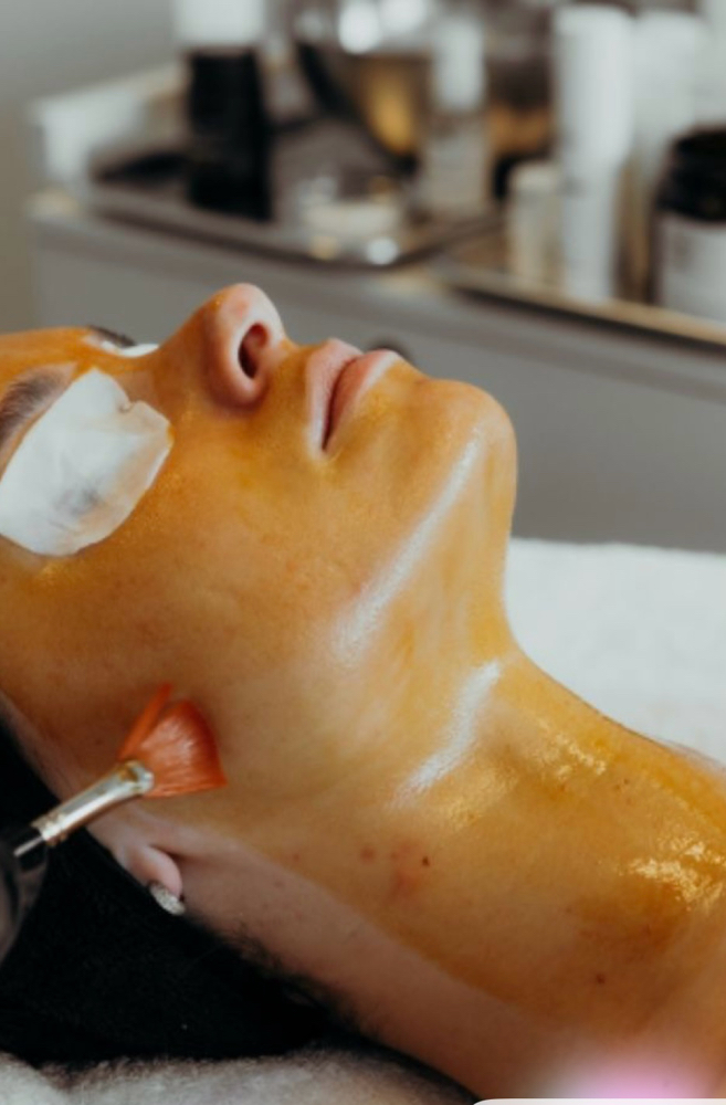 Chemical Peels at Hanna Horne Esthetics in Goldsboro, NC