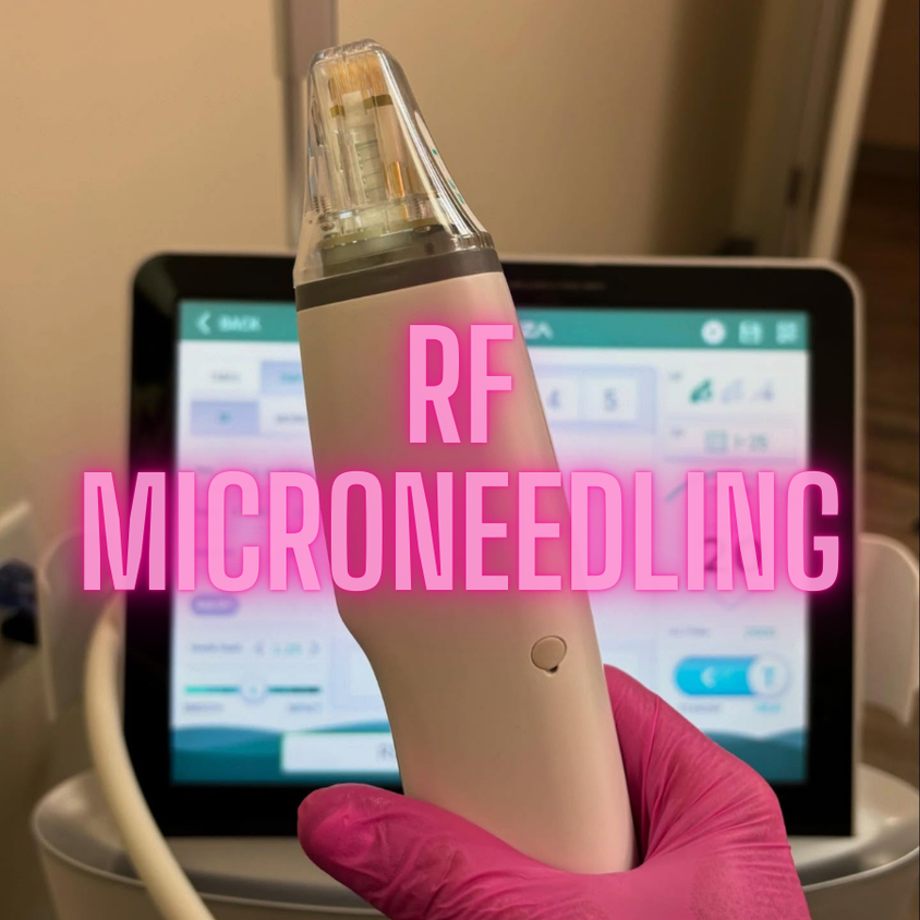 Potenza RF Microneedling