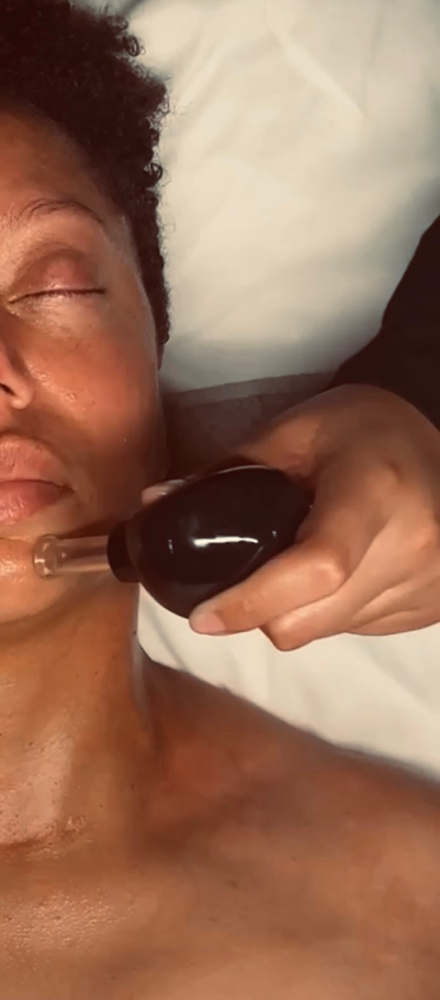 Facial Cupping