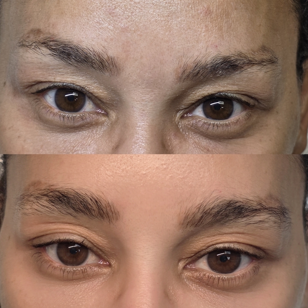 Eyebrow Reconstruction 4 sessions at Jackie Jacob Beauty in Matthews, NC