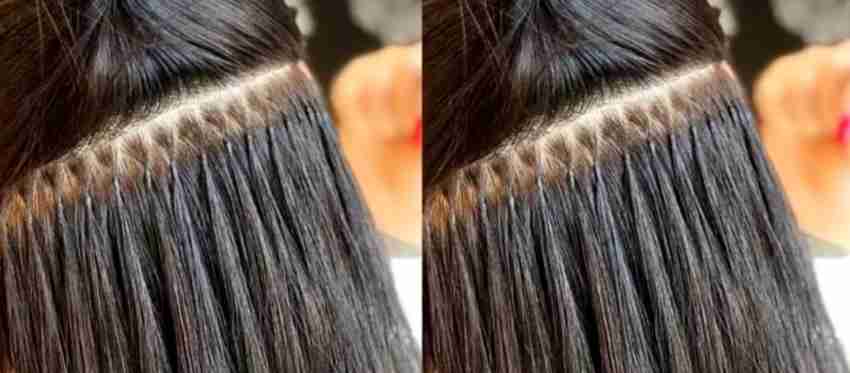 Extensions