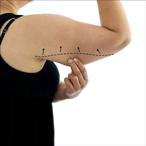 Triple Action Upper Arm Sculpt at Kerala Ayurveda Panchakarma Center LLC in brandon, FL