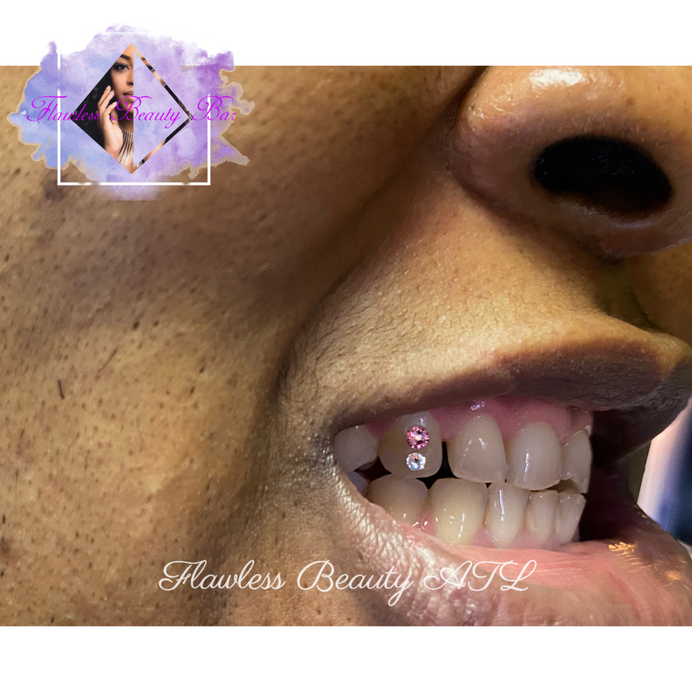 Tooth Gem Course