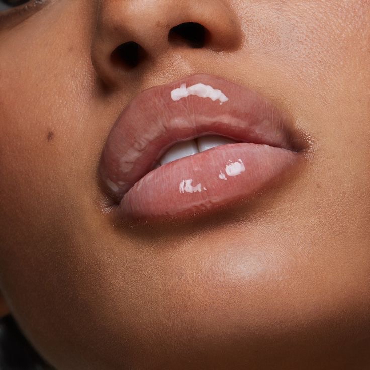 Lip Hair Removal