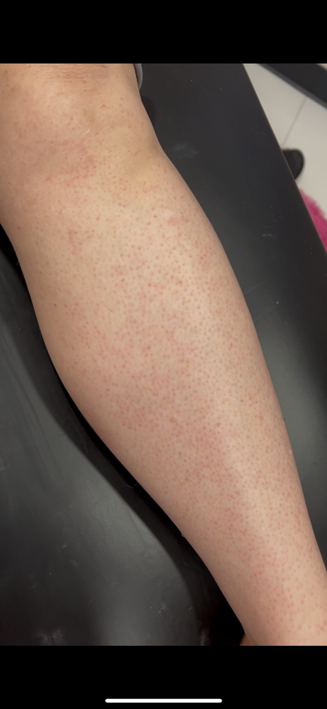 lower leg wax